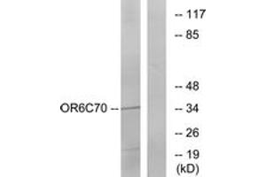 Western blot analysis of extracts from Jurkat cells, using OR6C70 Antibody. (OR6C70 Antikörper  (AA 231-280))