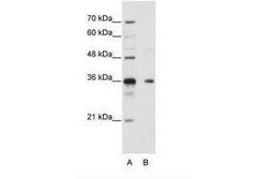 Image no. 1 for anti-Nanos Homolog 1 (NANOS1) (AA 157-206) antibody (ABIN202175) (Nanos Homolog 1 Antikörper  (AA 157-206))
