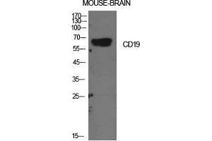 Western Blot (WB) analysis of Mouse Brain cells using CD19 Polyclonal Antibody. (CD19 Antikörper  (Internal Region))