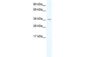 Western Blotting (WB) image for anti-Heat Shock Transcription Factor, Y Linked 2 (HSFY2) antibody (ABIN2461517)