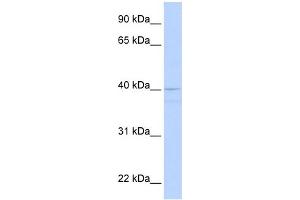 WB Suggested Anti-CREB3 Antibody Titration:  0. (CREB3 Antikörper  (Middle Region))