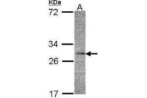 WB Image Sample(30 μg of whole cell lysate) A:HeLa S3, 12% SDS PAGE antibody diluted at 1:200 (IL22RA2 Antikörper)
