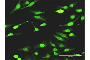 Immunofluorescence (IF) image for anti-SMAD, Mothers Against DPP Homolog 7 (SMAD7) (AA 160-260) antibody (ABIN517661)