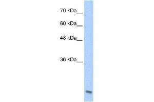 WB Suggested Anti-AES Antibody Titration:  2. (AES Antikörper  (C-Term))