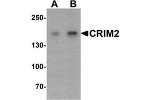 Western blot analysis of CRIM2 in Jurkat cell lysate with CRIM2 Antibody  at (A) 1 and (B) 2 ug/ml.