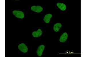 Immunofluorescence (IF) image for anti-DNA Fragmentation Factor, 45kDa, alpha Polypeptide (DFFA) (AA 1-331) antibody (ABIN514953)