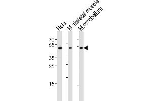 Western blot analysis of lysates from Hela cell line, mouse skeletal muscle and mouse cerebellum tissue lysate(from left to right), using Mouse Hoxc10 Antibody at 1:1000 at each lane.