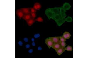 ABIN6256345 and ABIN6267674 staining Hela cells(24h of starvation treatment) by IF/ICC.