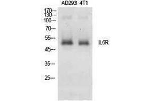 Western Blotting (WB) image for anti-Interleukin 6 Receptor, alpha (IL6RA) (Internal Region) antibody (ABIN3178892) (IL6RA Antikörper  (Internal Region))