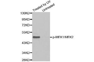 Western blot analysis of extracts from Hela cell untreated or treated with UV using Phospho-MAP2K1/MAP2K2-S217/S221 antibody (MEK1 Antikörper  (pSer221, Ser217, Ser221))