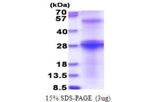 SDS-PAGE (SDS) image for Hepatitis C Virus Envelope Protein E2 (HCV E2) (AA 482-671) protein (His tag) (ABIN5853806) (HCV E2 Protein (AA 482-671) (His tag))