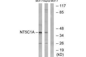 Western blot analysis of extracts from MCF-7 cells and HepG2 cells, using NT5C1A antibody. (NT5C1A Antikörper)