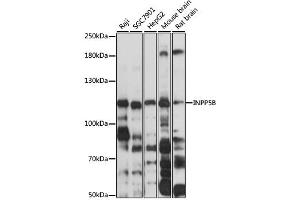 Western blot analysis of extracts of various cell lines, using INPP5B antibody (ABIN6292588) at 1:3000 dilution. (INPP5B Antikörper)