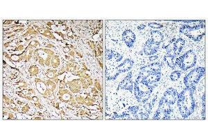 Immunohistochemistry (IHC) image for anti-Fucosyltransferase 3 (Galactoside 3(4)-L-Fucosyltransferase, Lewis Blood Group) (FUT3) (Internal Region) antibody (ABIN1851348) (FUT3 Antikörper  (Internal Region))
