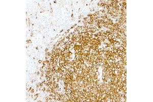 Immunohistochemistry (IHC) image for anti-HLA-DR (HLA-DR) antibody (ABIN7449537) (HLA-DR Antikörper)