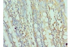 Immunohistochemistry of paraffin-embedded human colon tissue using ABIN7170676 at dilution of 1:100