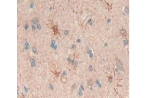 IHC-P analysis of Human Tissue, with DAB staining. (BMPER Antikörper  (AA 40-289))