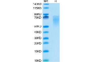 CD86 Protein (CD86) (AA 26-240) (His tag)