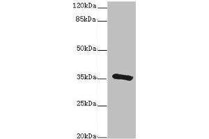 GDA Antikörper  (AA 165-454)