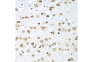 Immunohistochemistry of paraffin-embedded mouse brain using S antibody (ABIN1682621, ABIN3018891, ABIN3018892 and ABIN6220612) at dilution of 1:100 (40x lens). (SAP18 Antikörper  (AA 21-172))
