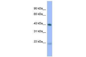 WB Suggested Anti-PRKACA Antibody Titration: 0.