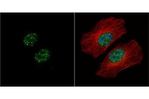 ICC/IF Image HMBOX1 antibody [N3C3] detects HMBOX1 protein at nucleus by immunofluorescent analysis. (HMBOX1 Antikörper)