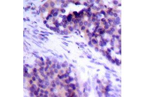 Immunohistochemistry (IHC) image for anti-BCL2-Like 1 (BCL2L1) (pSer62) antibody (ABIN1870015) (BCL2L1 Antikörper  (pSer62))