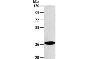 Western Blot analysis of Raji cell using ACMSD Polyclonal Antibody at dilution of 1:400 (ACMSD Antikörper)