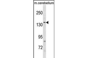 GRIN2C Antikörper  (AA 567-595)