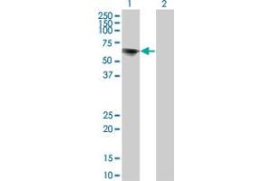 Western Blot analysis of TOE1 expression in transfected 293T cell line by TOE1 monoclonal antibody (M02), clone 1C12. (TOE1 Antikörper  (AA 1-510))