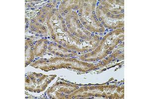 Immunohistochemistry of paraffin-embedded rat kidney using PDCD6IP antibody (ABIN5971240) at dilution of 1/100 (40x lens).