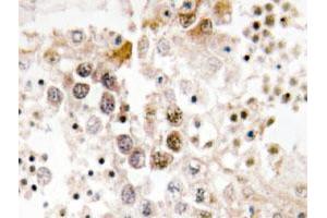 Immunohistochemical analysis of paraffin-embedded human testis tissue using FOXL1 polyclonal antibody . (FOXL1 Antikörper)