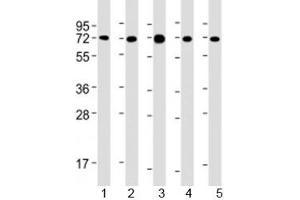 Western blot testing of human 1) MCF-7, 2) PC-3, 3) COS-7, 4) DU-145 and 5) SK-BR-3 cell lysate with USP2 antibody at 1:2000. (USP2 Antikörper  (AA 1-258))