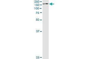 Western Blotting (WB) image for anti-Tripartite Motif Containing 24 (TRIM24) (AA 432-569) antibody (ABIN599067) (TRIM24 Antikörper  (AA 432-569))
