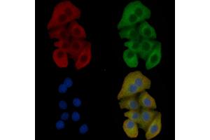 IREB1 Mouse Monoclonal Antibody staining Hela cells by IF/ICC.
