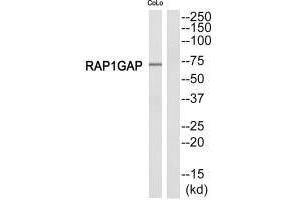 Western blot analysis of extracts from COLO205 cells, using RAP1GDS1 antibody. (RAP1GAP Antikörper  (C-Term))