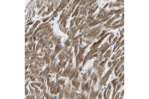 Immunohistochemical staining of human heart muscle with TMEM204 polyclonal antibody  shows strong cytoplasmic positivity in myocytes.