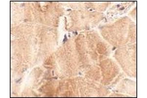 Immunohistochemistry of JPH2 in mouse skeletal muscle tissue with this product at 2.