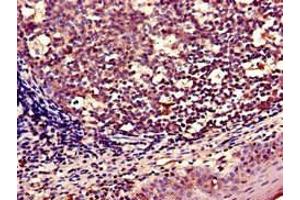 Immunohistochemistry of paraffin-embedded human tonsil tissue using ABIN7166304 at dilution of 1:100 (WNT5A Antikörper  (AA 62-380))