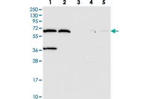 Western blot analysis of Lane 1: RT-4, Lane 2: U-251 MG, Lane 3: Human Plasma, Lane 4: Liver, Lane 5: Tonsil with ADAMTSL5 polyclonal antibody . (ADAMTS-Like 5 Antikörper)