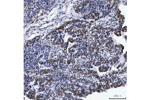 IHC analysis of Lamin A+C/LMNA using anti-Lamin A+C/LMNA antibody (ABIN7601843).