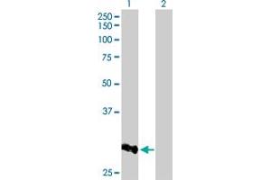 Western Blot analysis of CCNB1IP1 expression in transfected 293T cell line by CCNB1IP1 MaxPab polyclonal antibody. (CCNB1IP1 Antikörper  (AA 1-277))