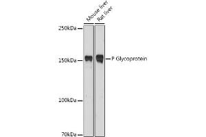 Western blot analysis of extracts of various cell lines, using P Glycoprotein antibody (ABIN6134228, ABIN6136339, ABIN6136342 and ABIN6215442) at 1:1000 dilution. (ABCB1 Antikörper  (AA 600-700))