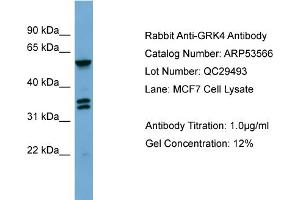 WB Suggested Anti-GRK4  Antibody Titration: 0. (GRK4 Antikörper  (Middle Region))