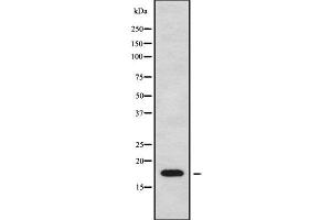 Western blot analysis of CKLF using Jurkat whole cell lysates (CKLF Antikörper  (C-Term))