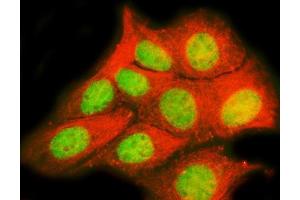 IF analysis of TRPS1 using anti-TRPS1 antibody (ABIN7601443) and anti-Tubulin Alpha antibody (ABIN7600339).