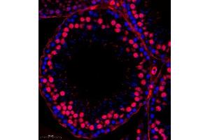 Immunofluorescence (Paraffin-embedded Sections) (IF (p)) image for anti-Apoptosis Inhibitor 5 (API5) antibody (ABIN7073094)