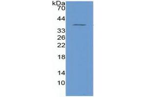 Western Blotting (WB) image for Nuclear Factor kappa B (NFkB) ELISA Kit (ABIN6730872)
