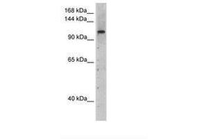 Image no. 1 for anti-PRP6 Pre-mRNA Processing Factor 6 Homolog (PRPF6) (AA 51-100) antibody (ABIN204965) (PRP6/ANT-1 Antikörper  (AA 51-100))