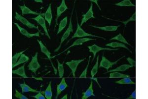 Immunofluorescence (IF) image for anti-Translocase of Inner Mitochondrial Membrane 8 Homolog B (TIMM8B) antibody (ABIN7258706)